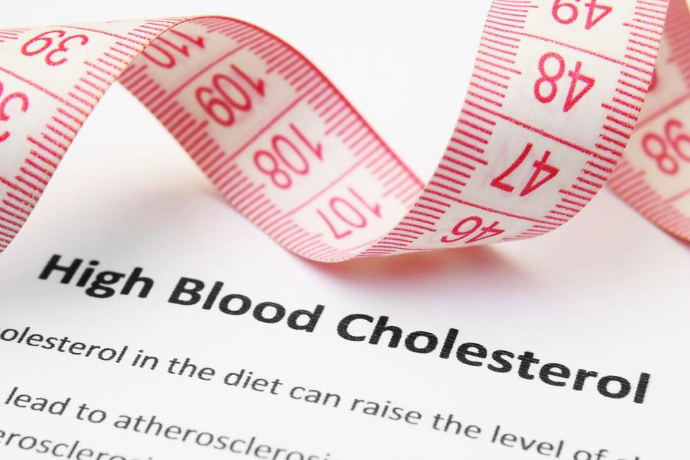 High Cholesterol – Symptoms and Treatment Options