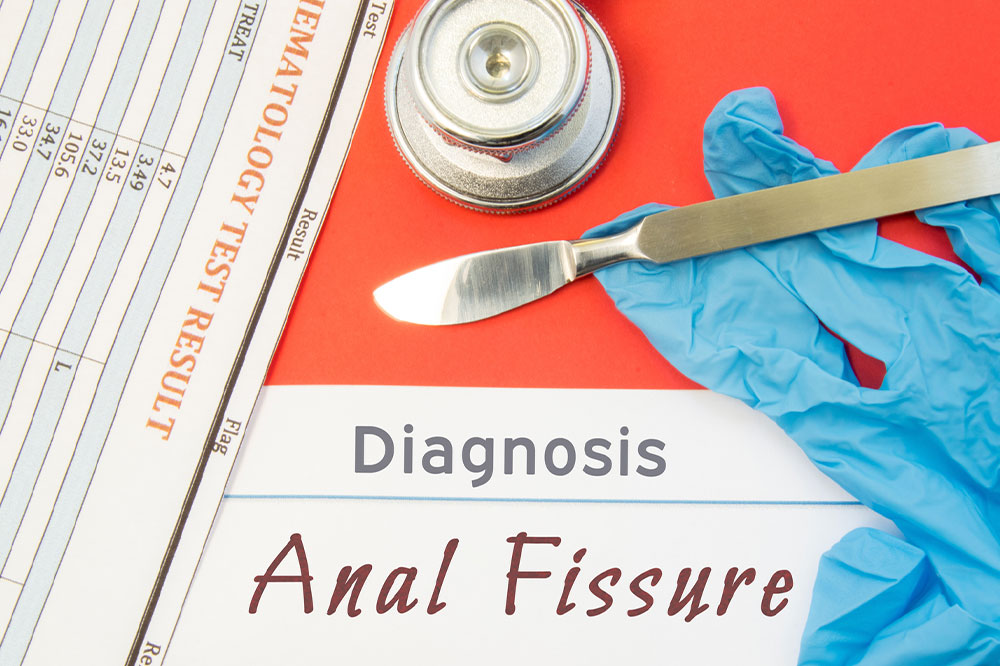Anal Fissures – Its Causes, Symptoms, and Management